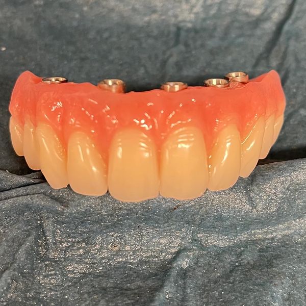 Removable Dental Lab Removable Dental Appliances